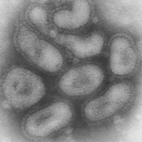 gripe a h1n1 porcina